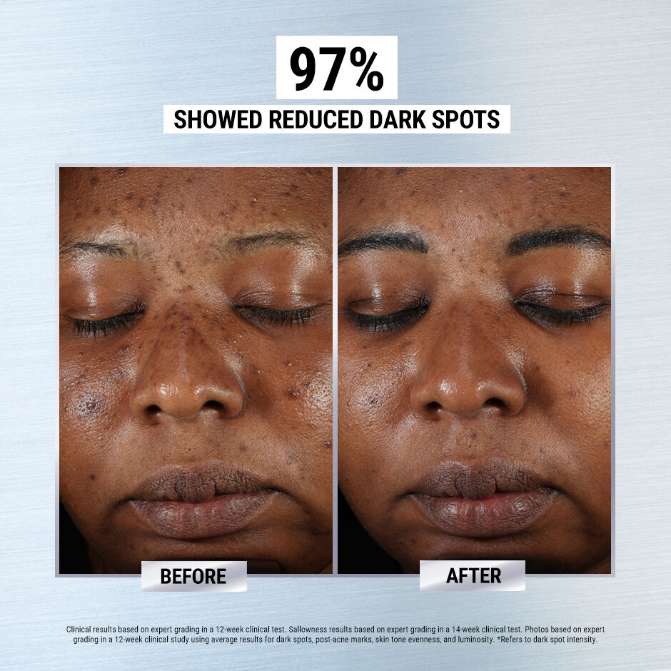 Kiehl's dark sales spot corrector